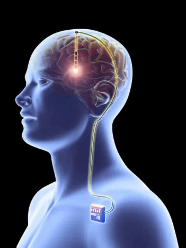 5 Proven Memory Boosting Techniques to Supercharge Your Brain